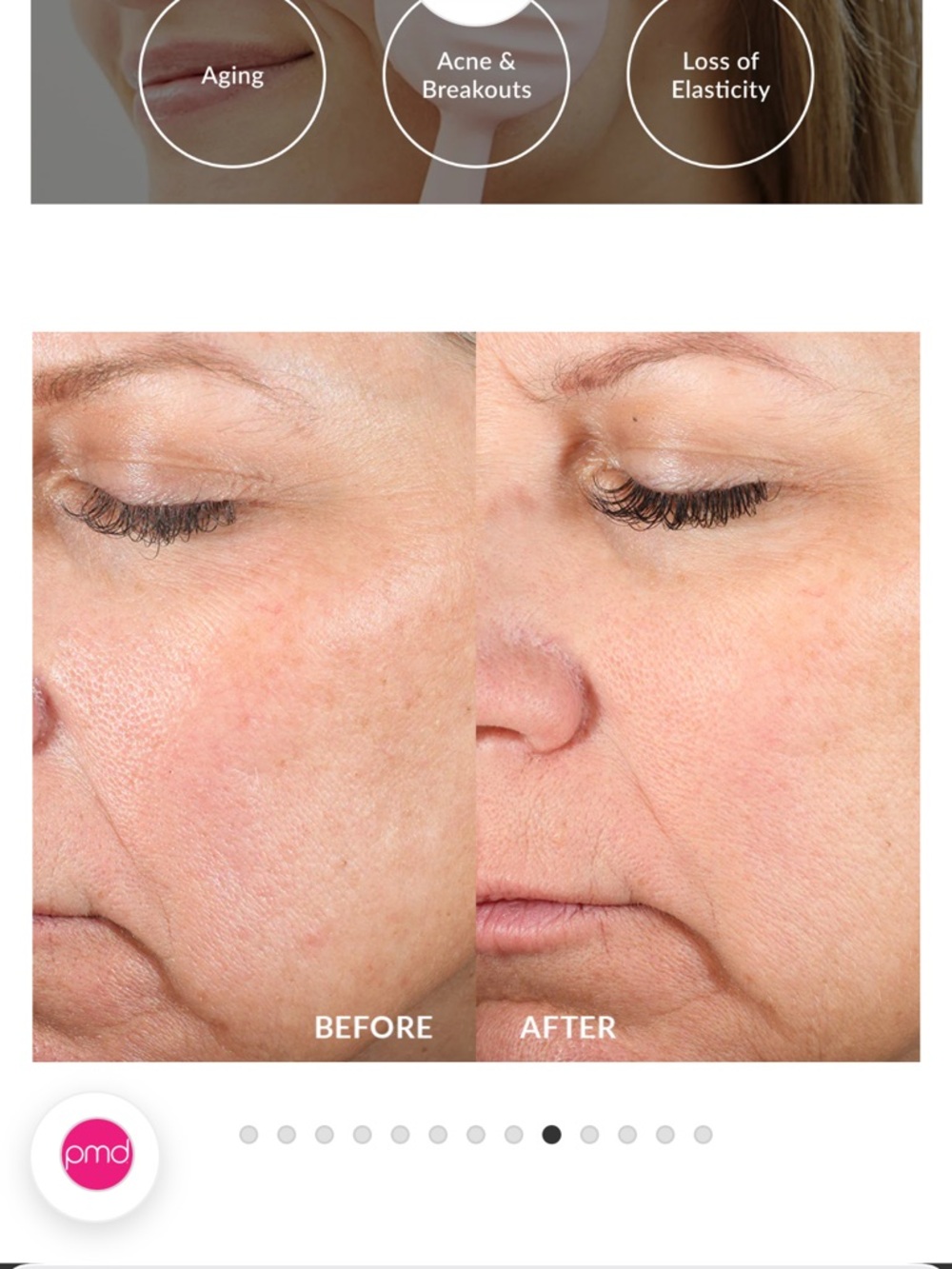 PMD facial device - Picture 10 of 10